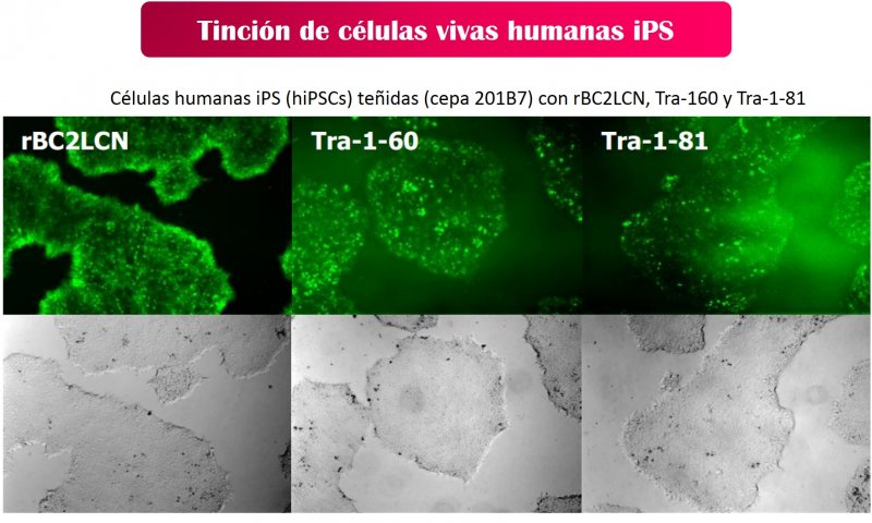  Tinción de células vivas humanas iPS