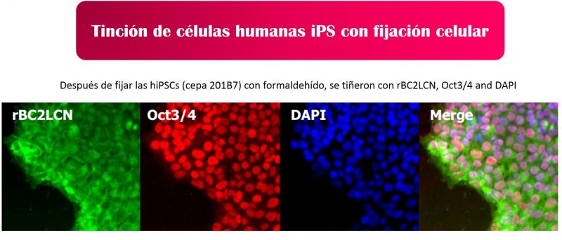 Tinción de células vivas humanas iPS con fijación celular