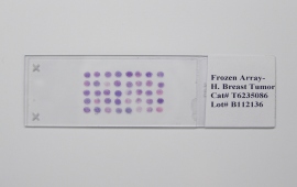 Biochain: Muestras de tejido (Secciones de tejidos congelados, FFPE)