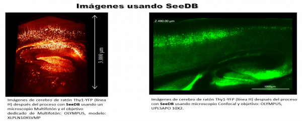 Embrión y cerebro de ratón antes y después de ser tratados con SeeDB