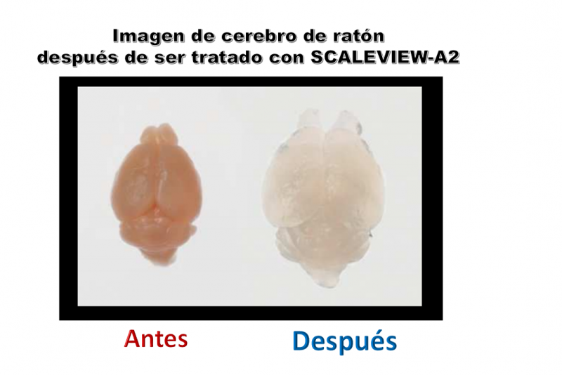 Cerebro de ratón tratado con SCALEVIEW-A2
